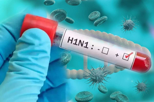 Namibia records 54 H1N1 cases