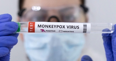 New Monkeypox symptoms are making cases harder to recognise