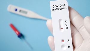 SA pathology groups agree to lower Covid-19 rapid antigen test price to R150 or less